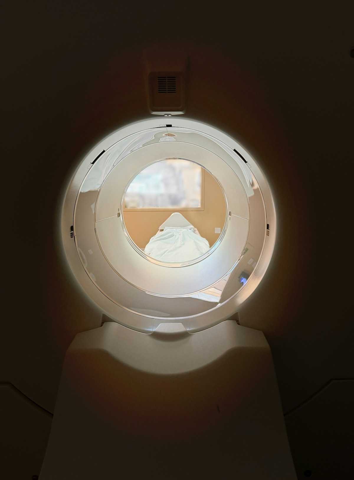 Scanner — tomodensitométrie haute résolution
